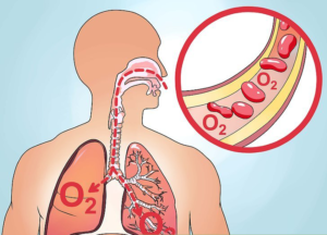 SIGNS AND SYMPTOMS OF CARBON MONOXIDE (CO) POISONING