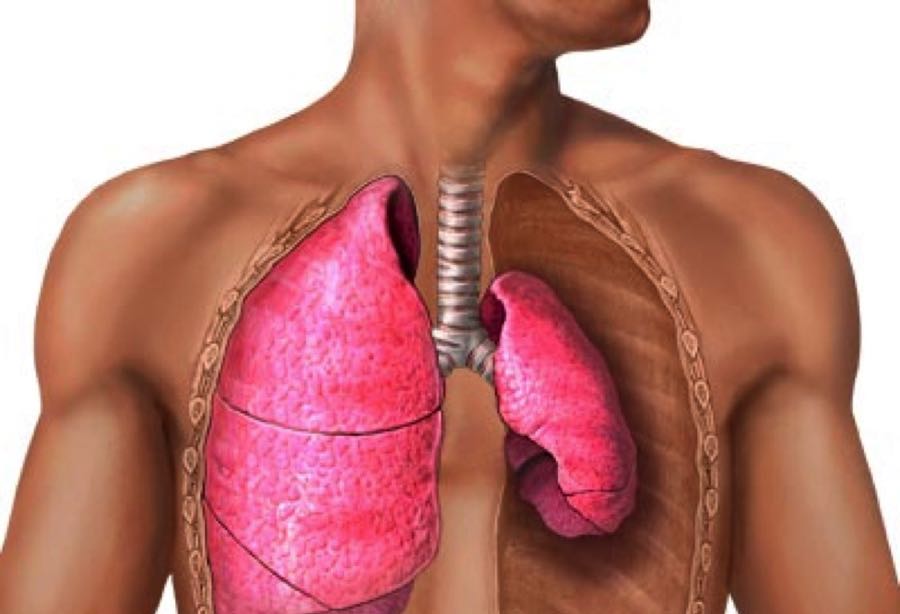 BAROTRAUMA PULMONAR: UNA GUÍA COMPLETA