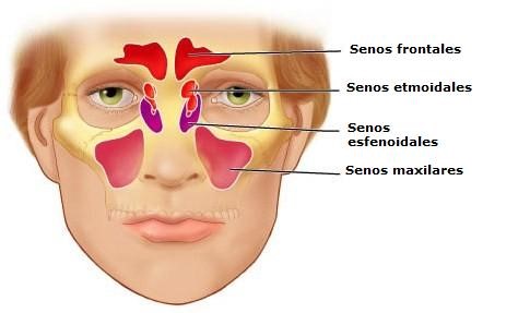 BAROTRAUMA DE SENOS PARANASALES: CAUSAS, SÍNTOMAS Y PREVENCIÓN